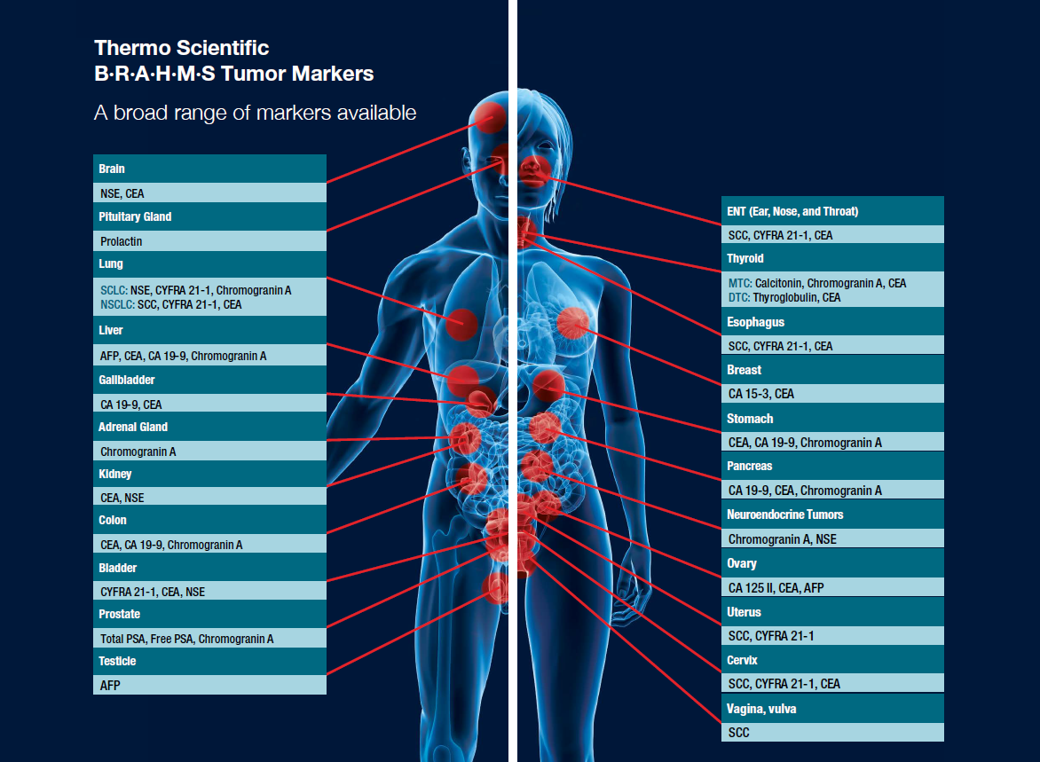 BRAHMS Tumor Markers in Oncology