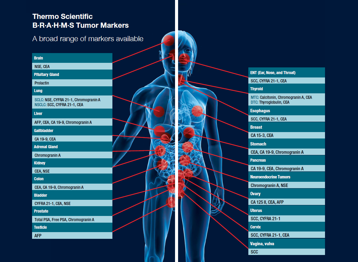 What Is The Tumor Marker For Pancreatic Cancer