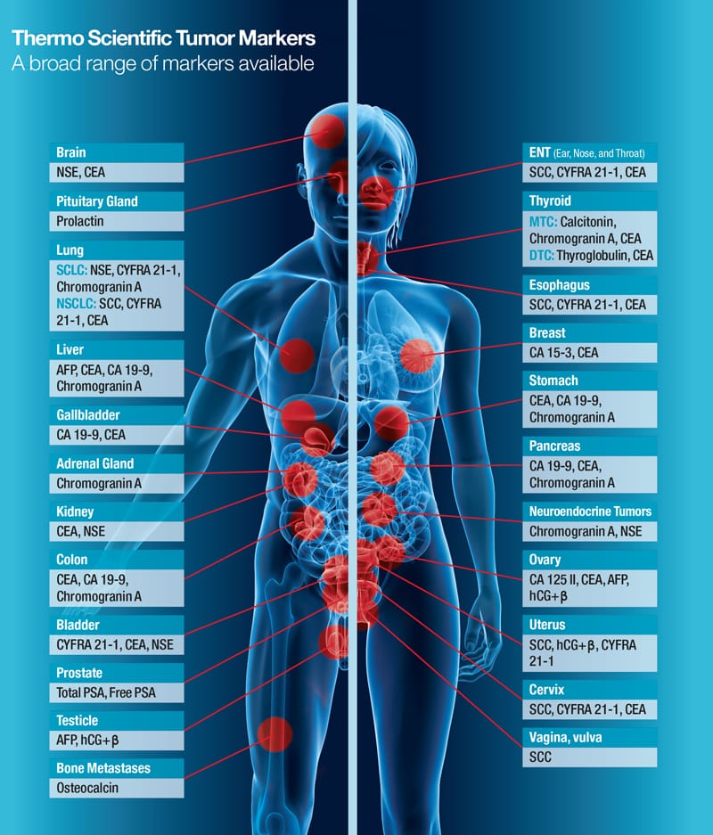 tumor-markers-oncology